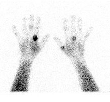 Imaging of human hands