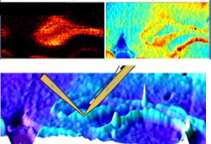 Multimodal Imaging