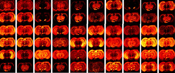 Mass spectrometry imaging