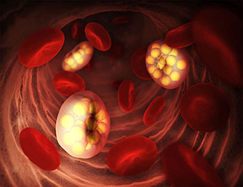 Malaria in red blood cells
