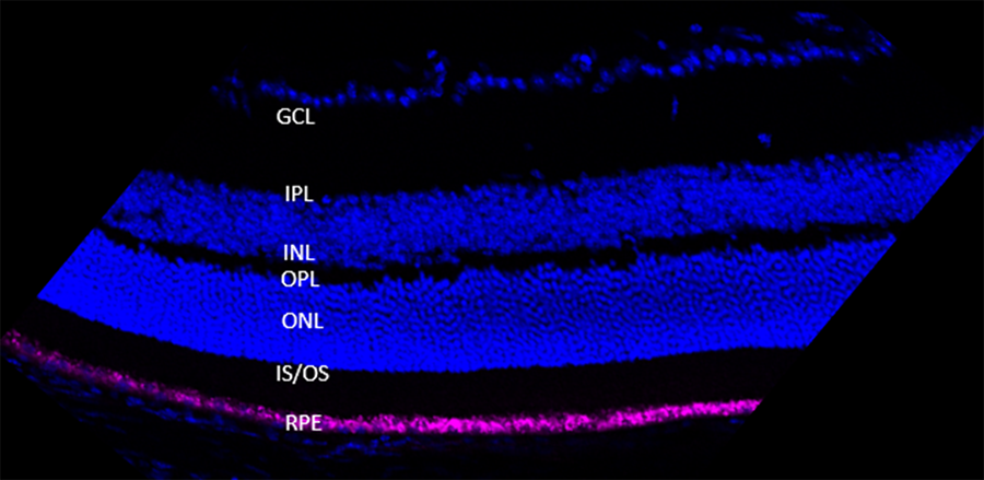 Targeting a fluorescent siRNA specifically to the retinal pigment epithelium (RPE) of the eye in a live mouse as a method to suppress AMD.