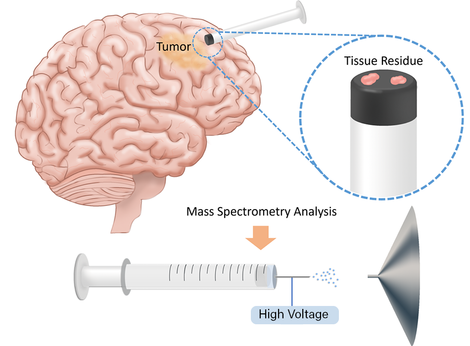 Graphic depicting the process of using mass spectrometry to detect brain cancer margins.