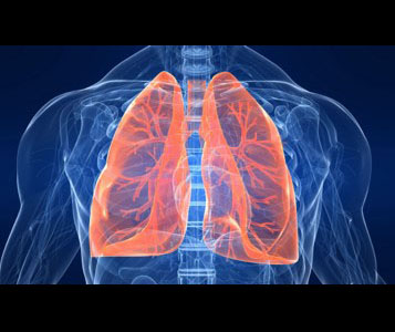 Xray example focusing on the lungs.